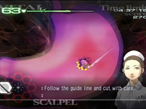 Trauma Center : Second Opinion - Wii